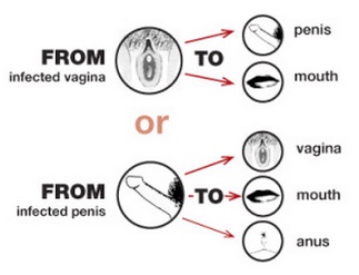 Is chlamydia contagious