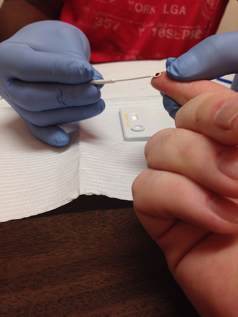 What is a HIV RNA Early Detection Test and How Does It Work?